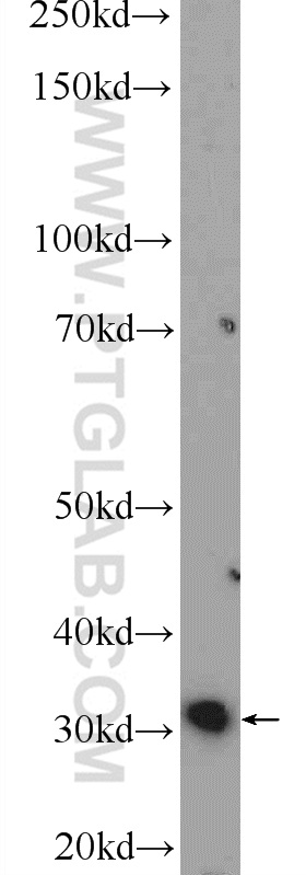 MDH2 Polyclonal antibody