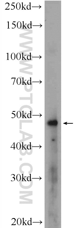 MDM2 Polyclonal antibody