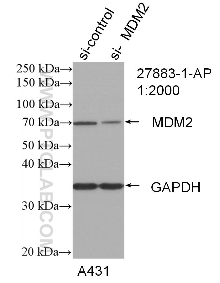 WB analysis of A431 using 27883-1-AP