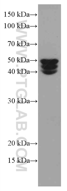 WB analysis of MCF-7 using 66511-1-Ig