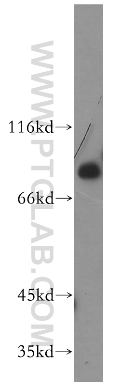 WB analysis of HeLa using 17914-1-AP