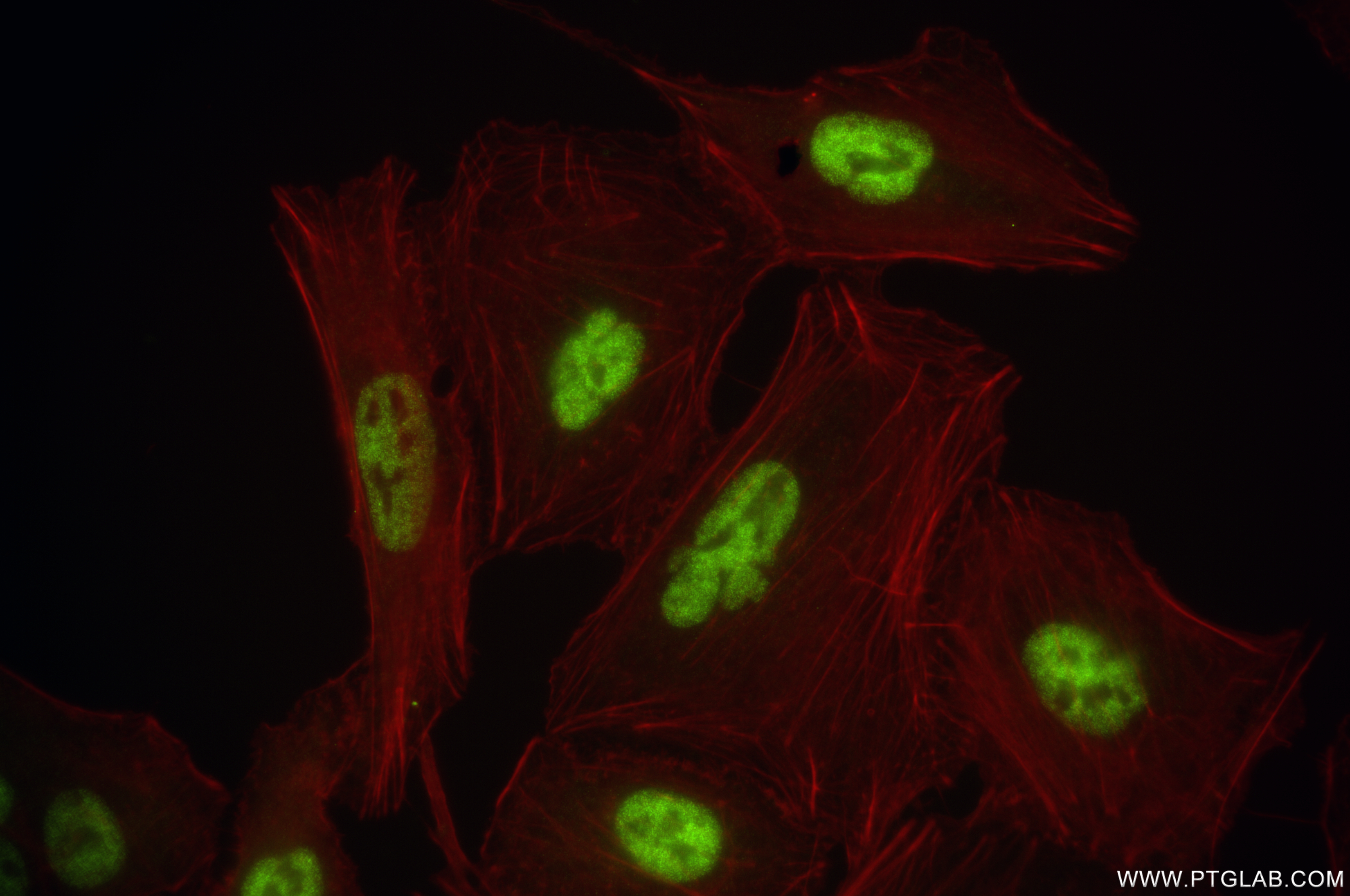IF Staining of A549 using 84534-6-RR (same clone as 84534-6-PBS)
