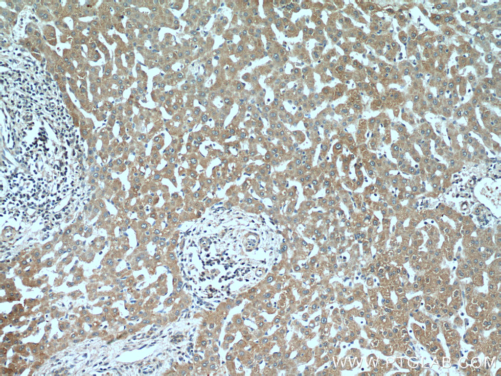 IHC staining of human liver using 13929-1-AP