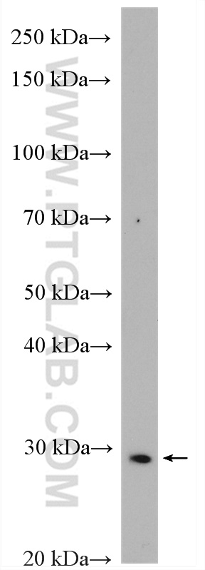 MDP-1