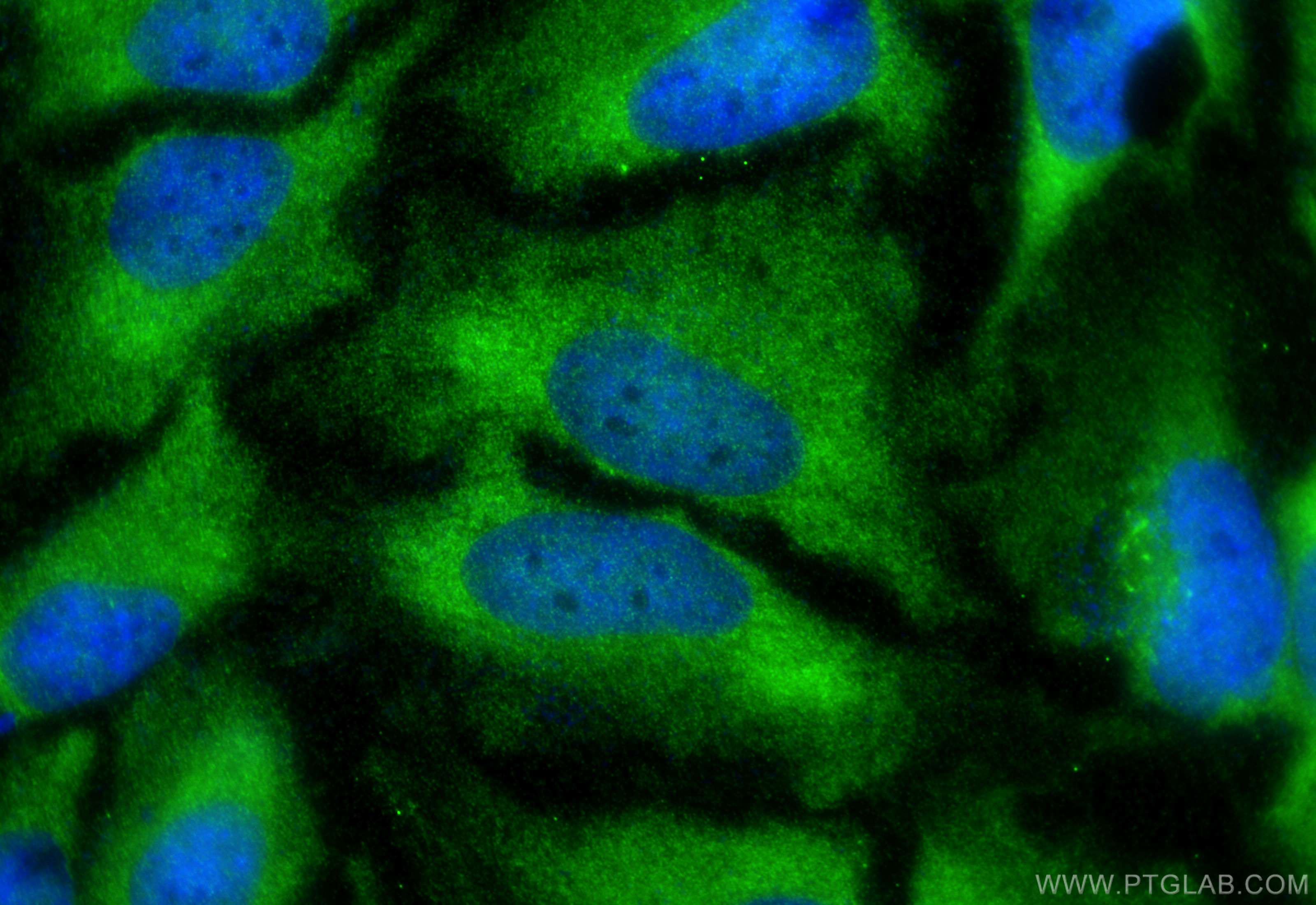 IF Staining of HeLa using 16619-1-AP