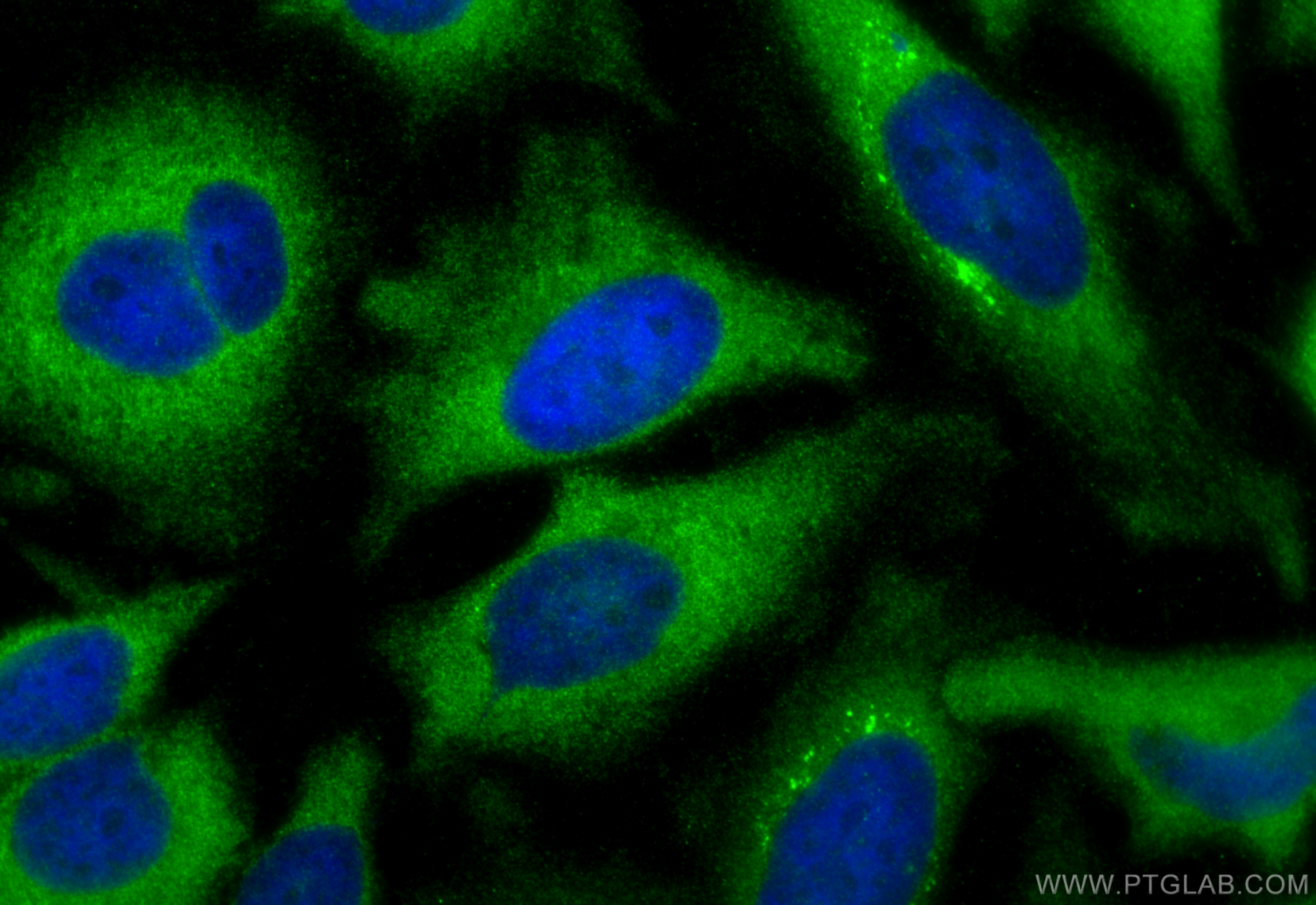 IF Staining of HeLa using 16619-1-AP
