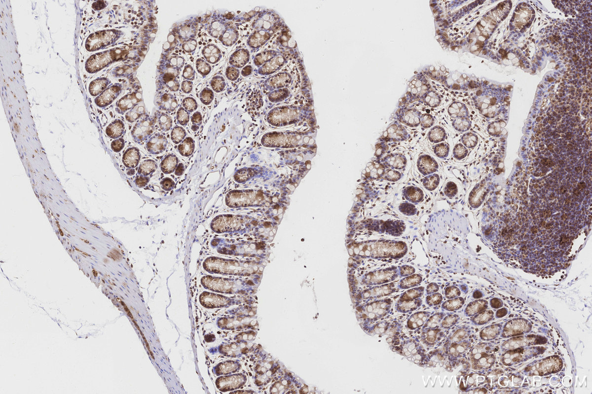 IHC staining of mouse colon using 24944-1-AP IHC staining of mouse colon using 24944-1-AP
