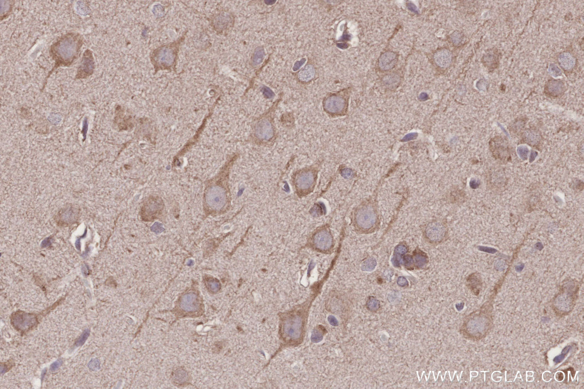IHC staining of rat brain using 24944-1-AP IHC staining of rat brain using 24944-1-AP