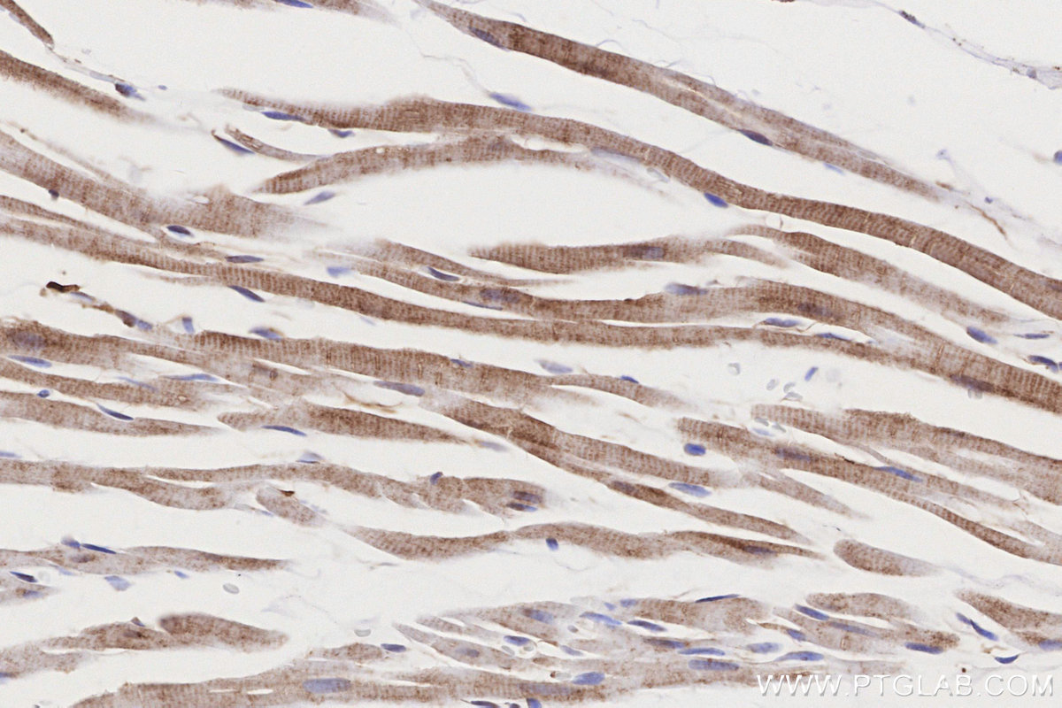 IHC staining of rat heart using 24944-1-AP IHC staining of rat heart using 24944-1-AP