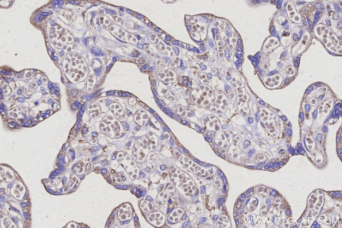 IHC staining of human placenta using 66472-1-Ig IHC staining of human placenta using 66472-1-Ig