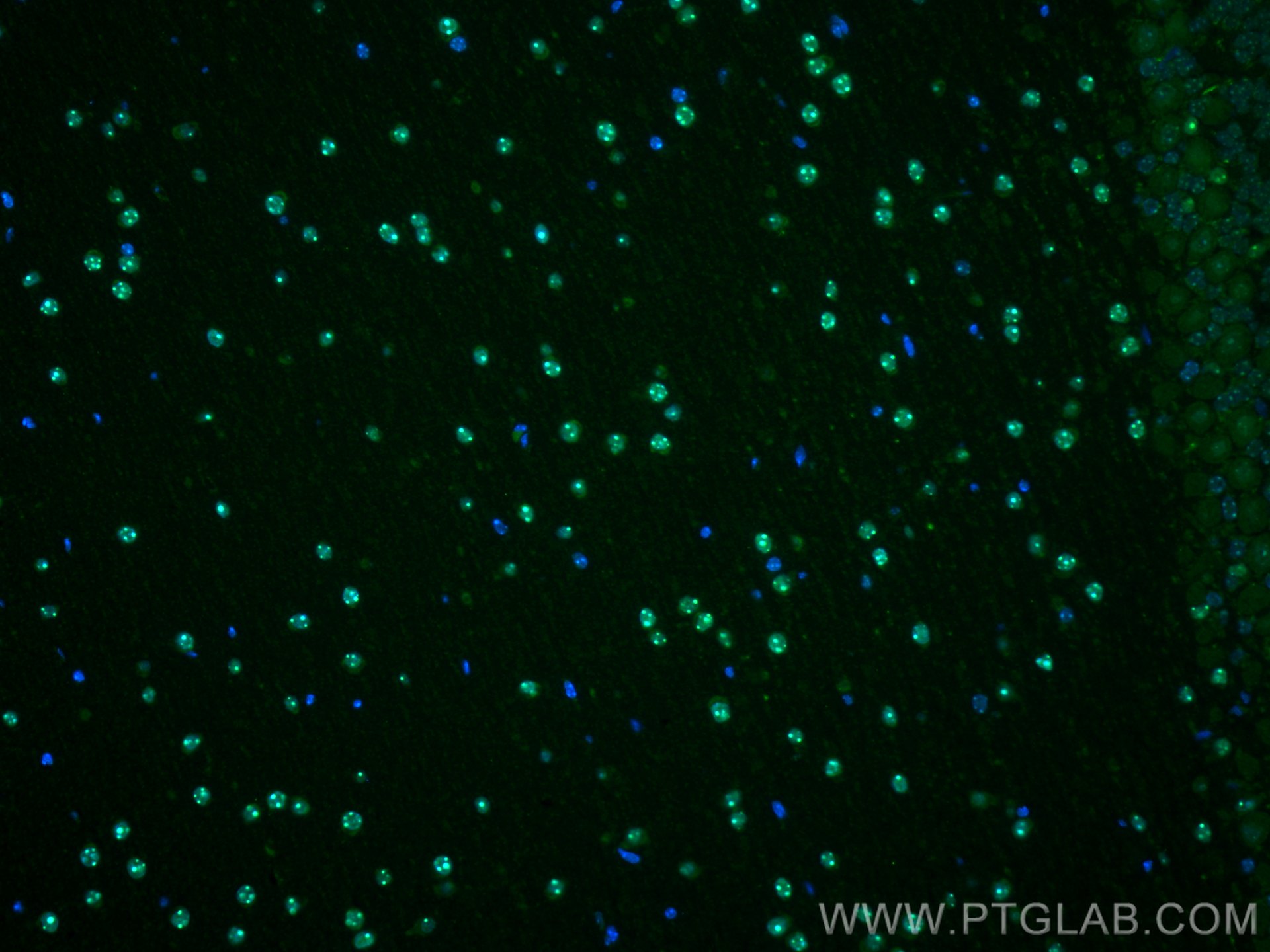 IF Staining of mouse cerebellum using 10861-1-AP