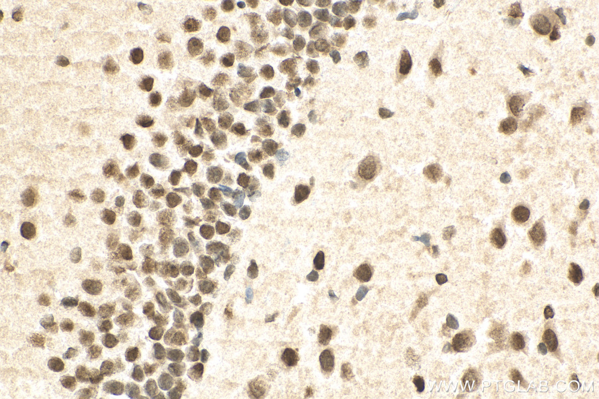 IHC staining of rat brain using 10861-1-AP