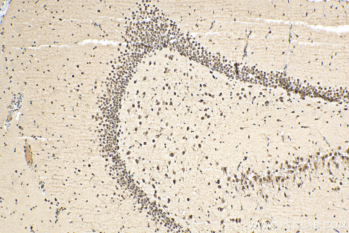 IHC staining of rat brain using 10861-1-AP