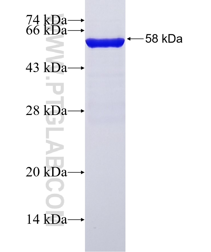 MECP2 fusion protein Ag29614 SDS-PAGE MECP2 fusion protein Ag29614 SDS-PAGE
