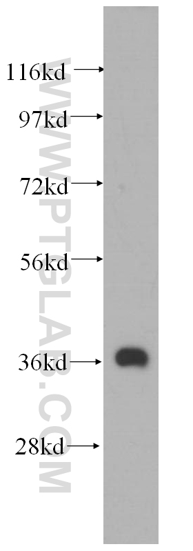 WB analysis of mouse heart using 14932-1-AP