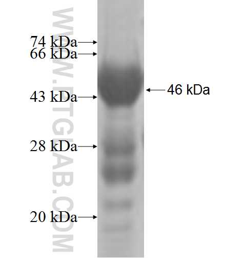 MECR fusion protein Ag6743 SDS-PAGE MECR fusion protein Ag6743 SDS-PAGE