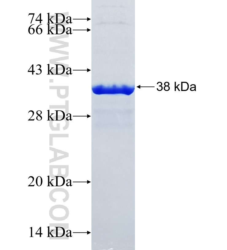 MED11 fusion protein Ag35310 SDS-PAGE MED11 fusion protein Ag35310 SDS-PAGE