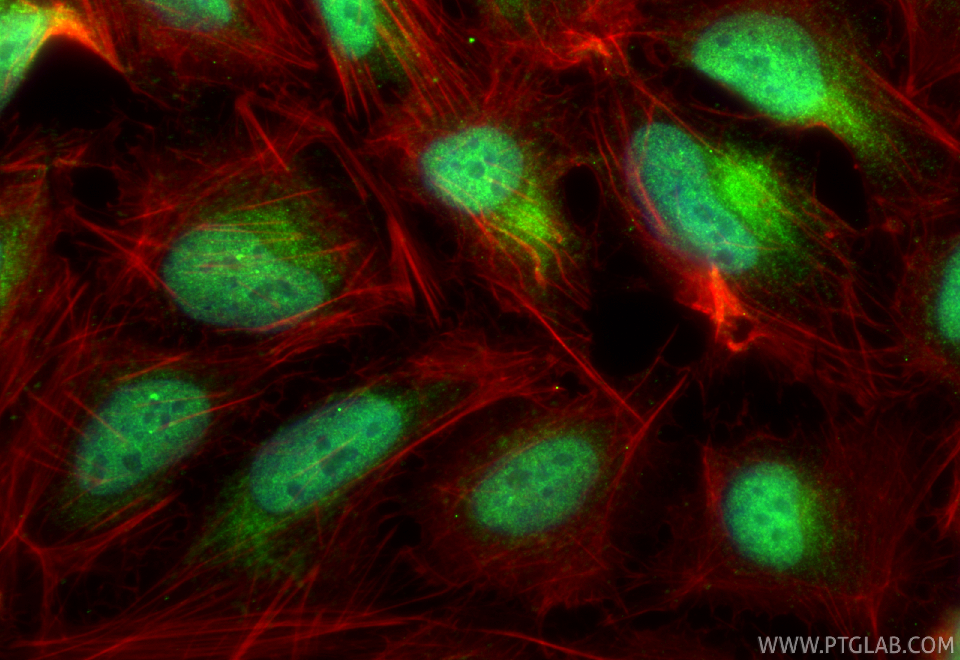 Immunofluorescent analysis of (4% PFA) fixed U2OS cells using MED12L antibody (20047-1-AP) at dilution of 1:400 and CoraLite®488-Conjugated Goat Anti-Rabbit IgG(H+L) (<a class='green' href='/productredirect?CatalogNo=SA00013-2' target='_blank'>SA00013-2</a>), CL594-Phalloidin (red). IF Staining of U2OS using 20047-1-AP