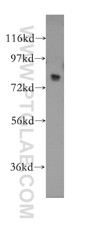 WB analysis of human liver using 11505-1-AP