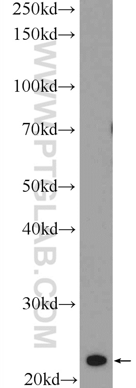 MED18 Polyclonal antibody