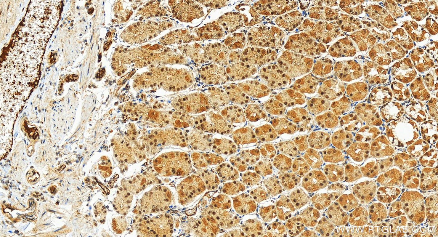 IHC staining of human stomach using 27850-1-AP
