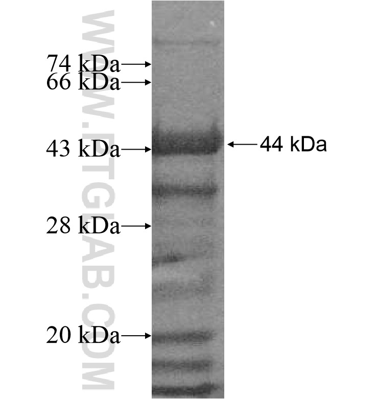 MED26 fusion protein Ag16915 SDS-PAGE MED26 fusion protein Ag16915 SDS-PAGE