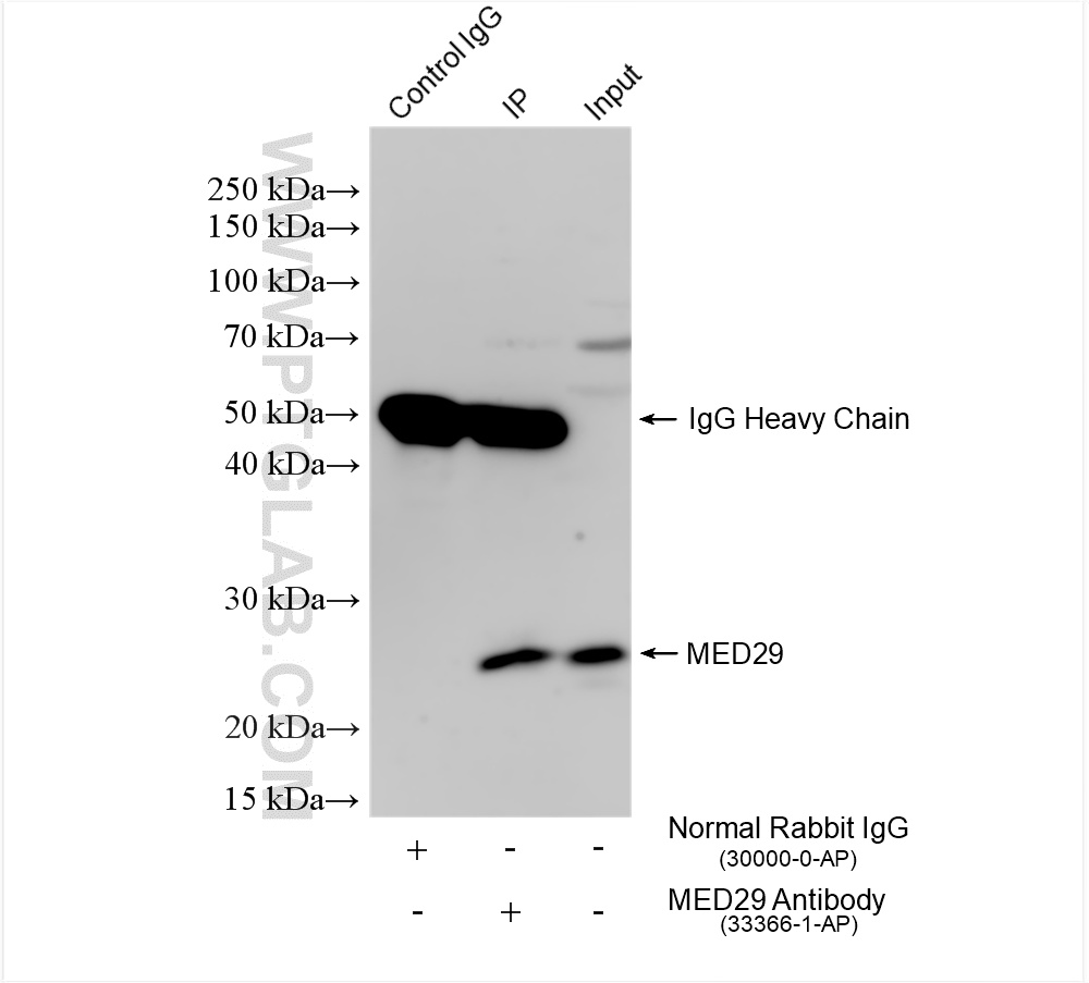 IP result of anti-MED29 (IP:33366-1-AP, 4ug; Detection:33366-1-AP 1:800) with HT-29 cells lysate 1760 ug. IP experiment of HT-29 using 33366-1-AP