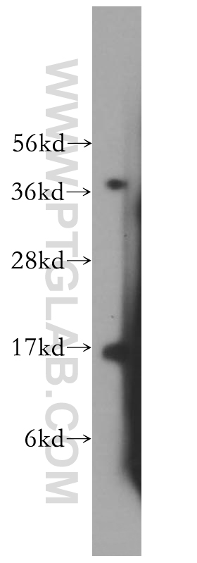 WB analysis of mouse testis using 16590-1-AP