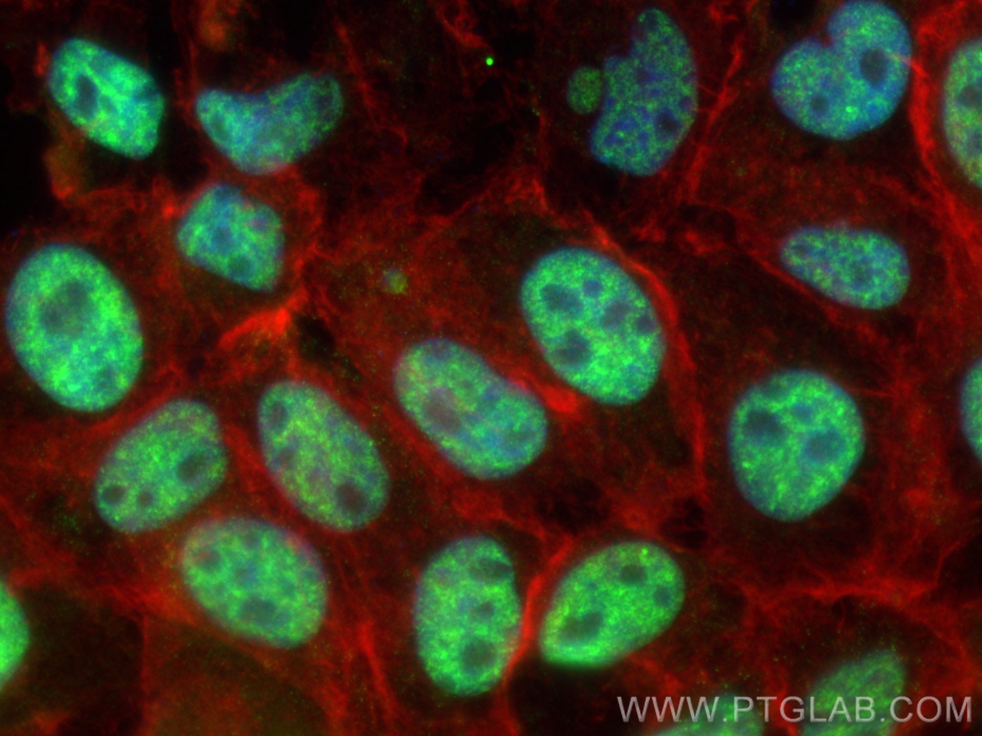 IF Staining of A431 using CL488-84184-5