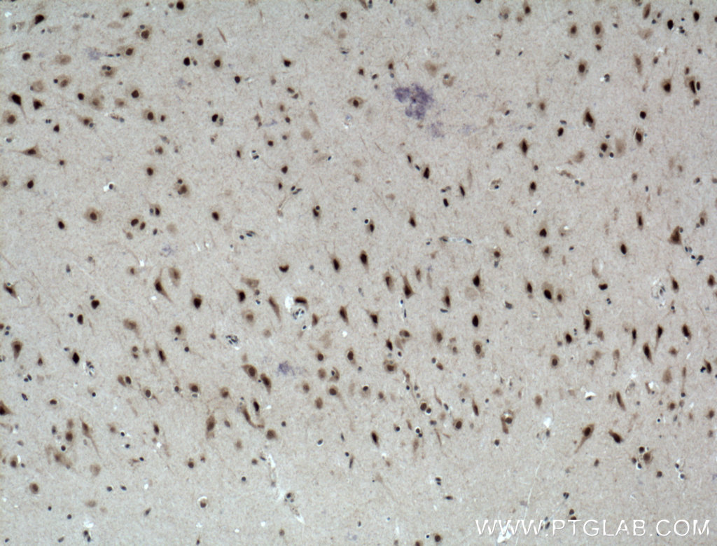 IHC staining of human brain using 12182-1-AP (same clone as 12182-1-PBS)
