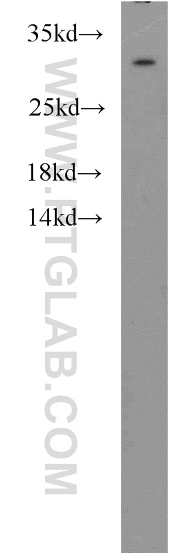 WB analysis of HepG2 using 12182-1-AP (same clone as 12182-1-PBS)