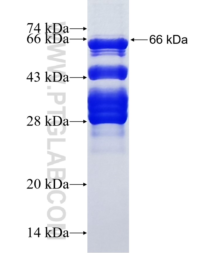 MEF2A fusion protein Ag3049 SDS-PAGE