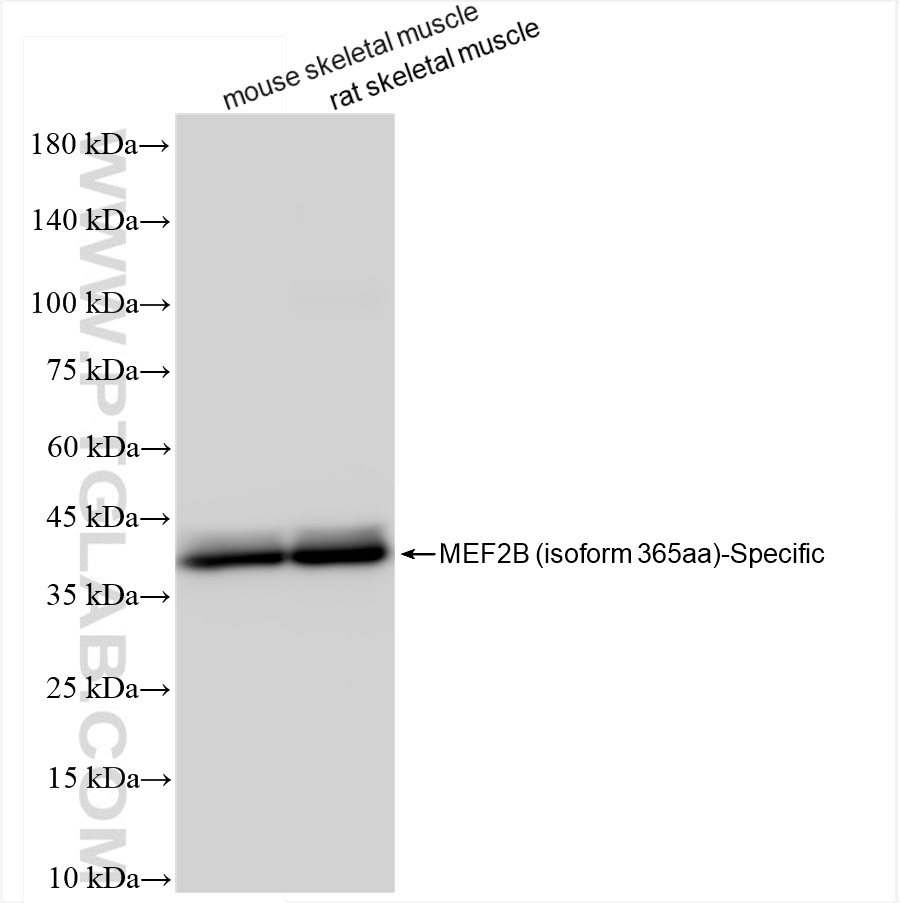 WB analysis using 84000-1-RR
