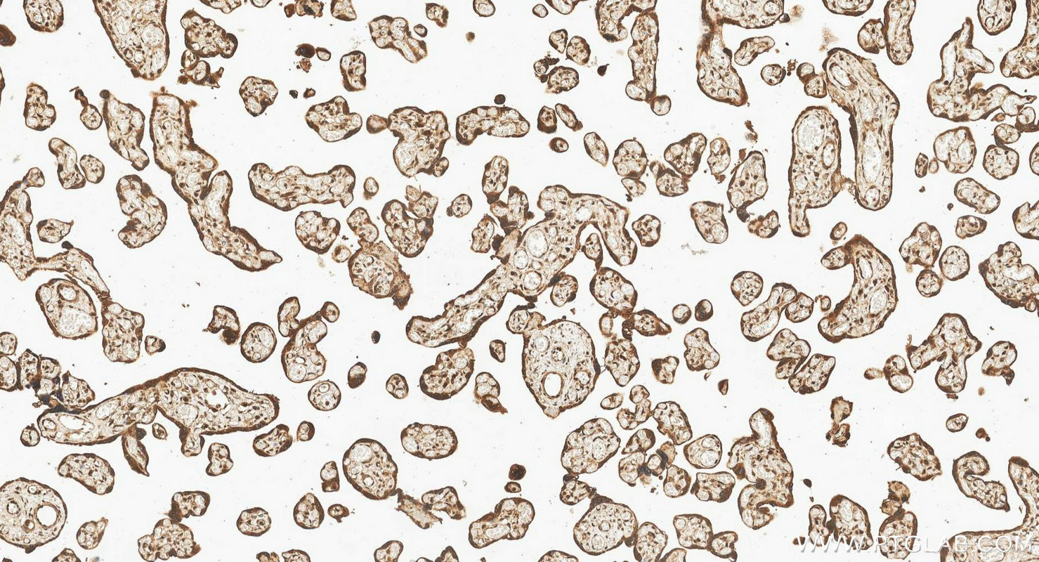 IHC staining of human placenta using 10056-1-AP IHC staining of human placenta using 10056-1-AP