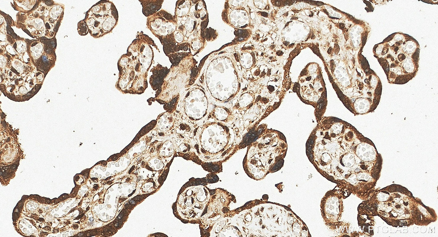 IHC staining of human placenta using 10056-1-AP IHC staining of human placenta using 10056-1-AP