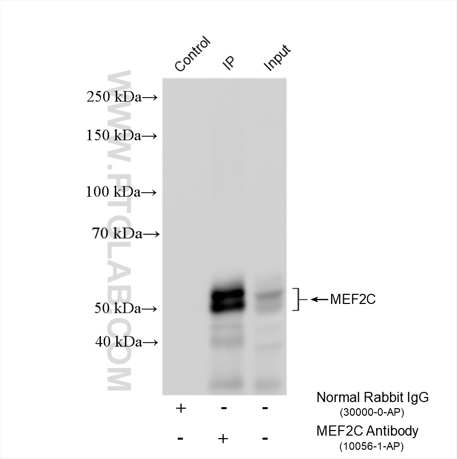 IP experiment of mouse brain using 10056-1-AP IP experiment of mouse brain using 10056-1-AP