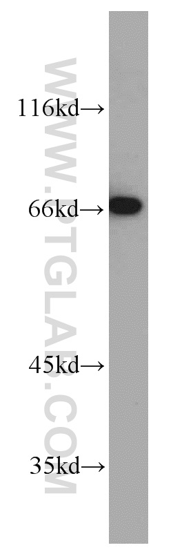 MEF2C Polyclonal antibody