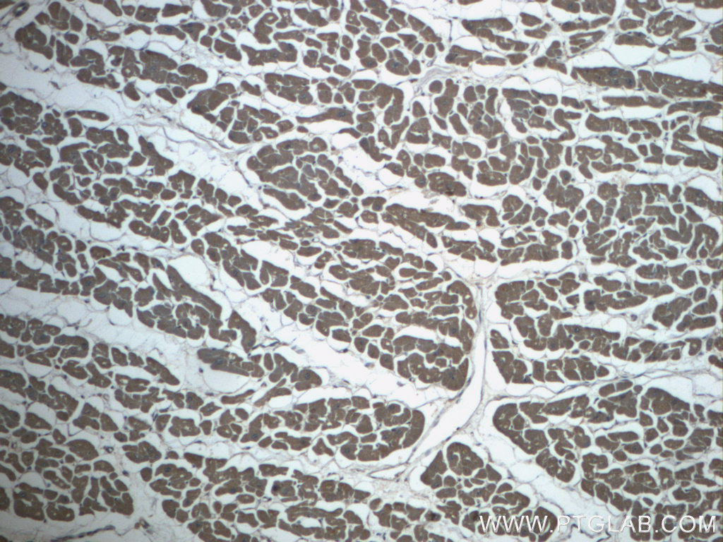 IHC staining of human heart using 20326-1-AP