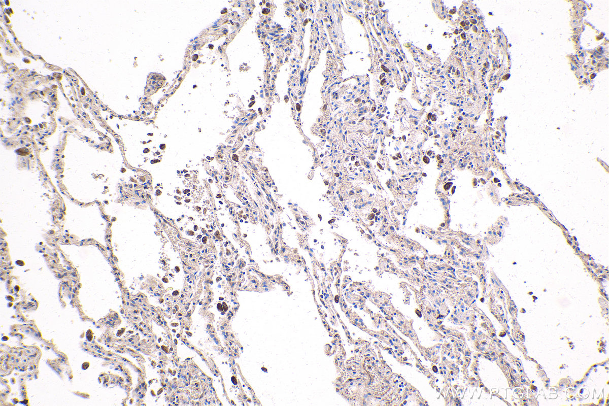 IHC staining of human lung using 20326-1-AP IHC staining of human lung using 20326-1-AP