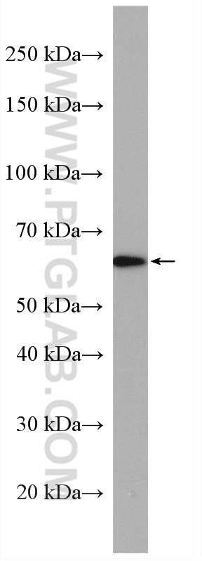 WB analysis of SH-SY5Y using 18293-1-AP