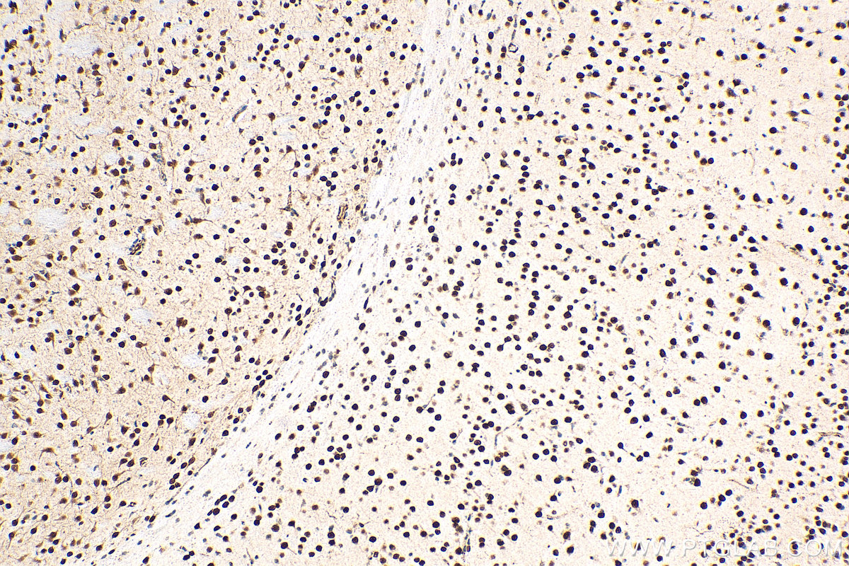 IHC staining of mouse brain using 14353-1-AP