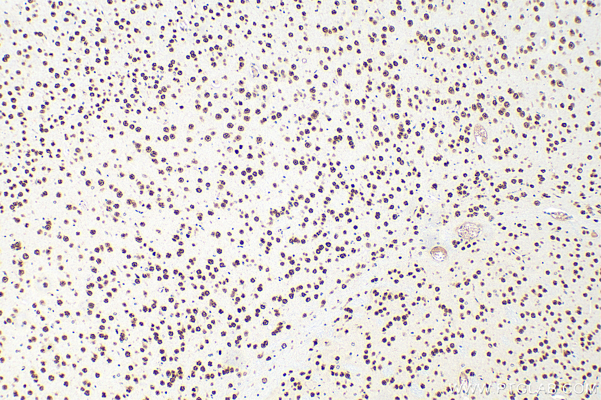 Immunohistochemical analysis of paraffin-embedded mouse brain tissue slide using 14353-1-AP (MEF2D antibody) at dilution of 1:800 (under 10x lens). Heat mediated antigen retrieval with Tris-EDTA buffer (pH 9.0). IHC staining of mouse brain using 14353-1-AP