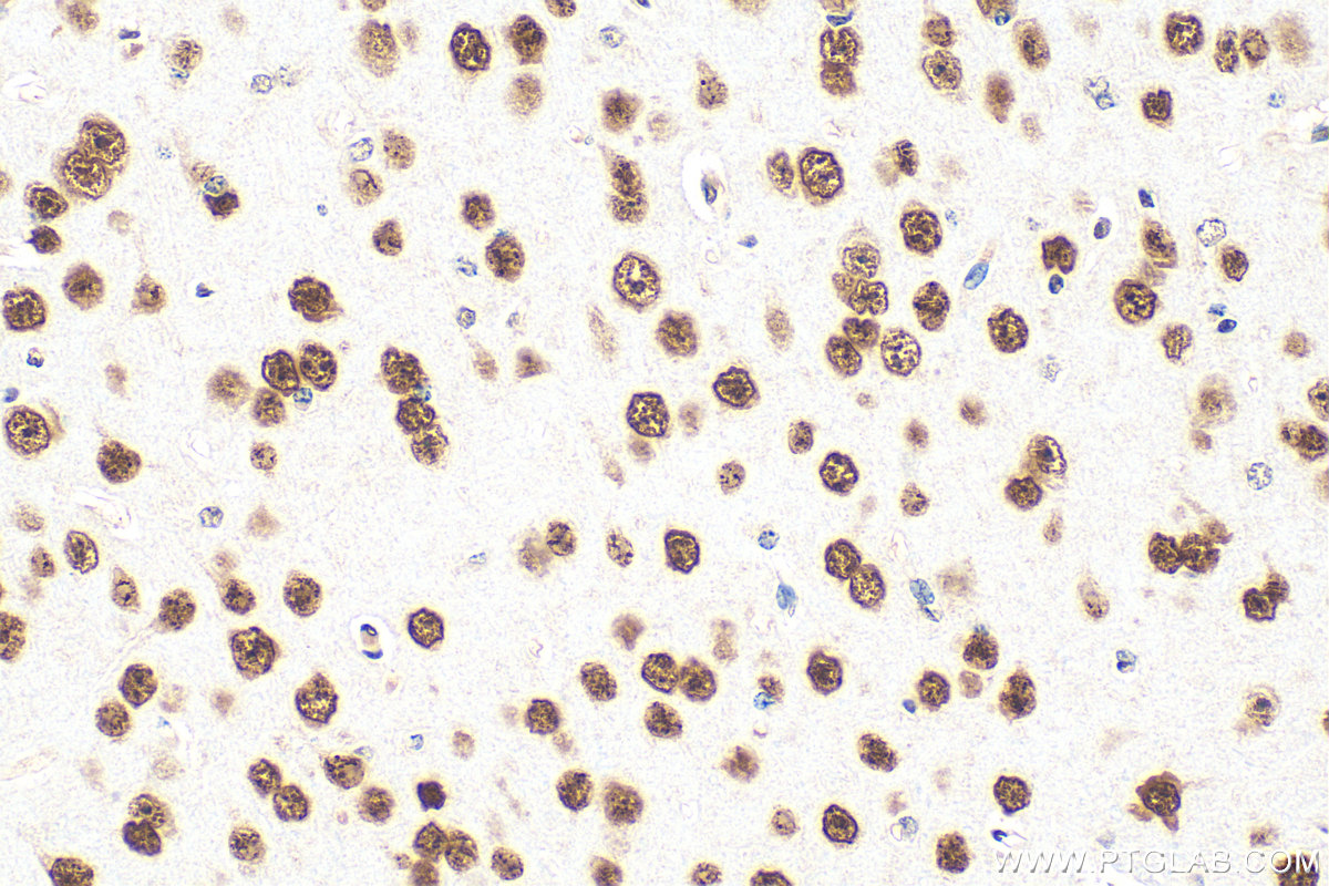 Immunohistochemical analysis of paraffin-embedded mouse brain tissue slide using 14353-1-AP (MEF2D antibody) at dilution of 1:800 (under 40x lens). Heat mediated antigen retrieval with Tris-EDTA buffer (pH 9.0). IHC staining of mouse brain using 14353-1-AP