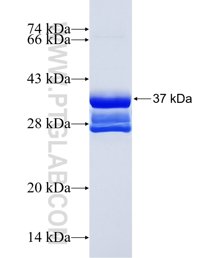MEGF10 fusion protein Ag18716 SDS-PAGE MEGF10 fusion protein Ag18716 SDS-PAGE