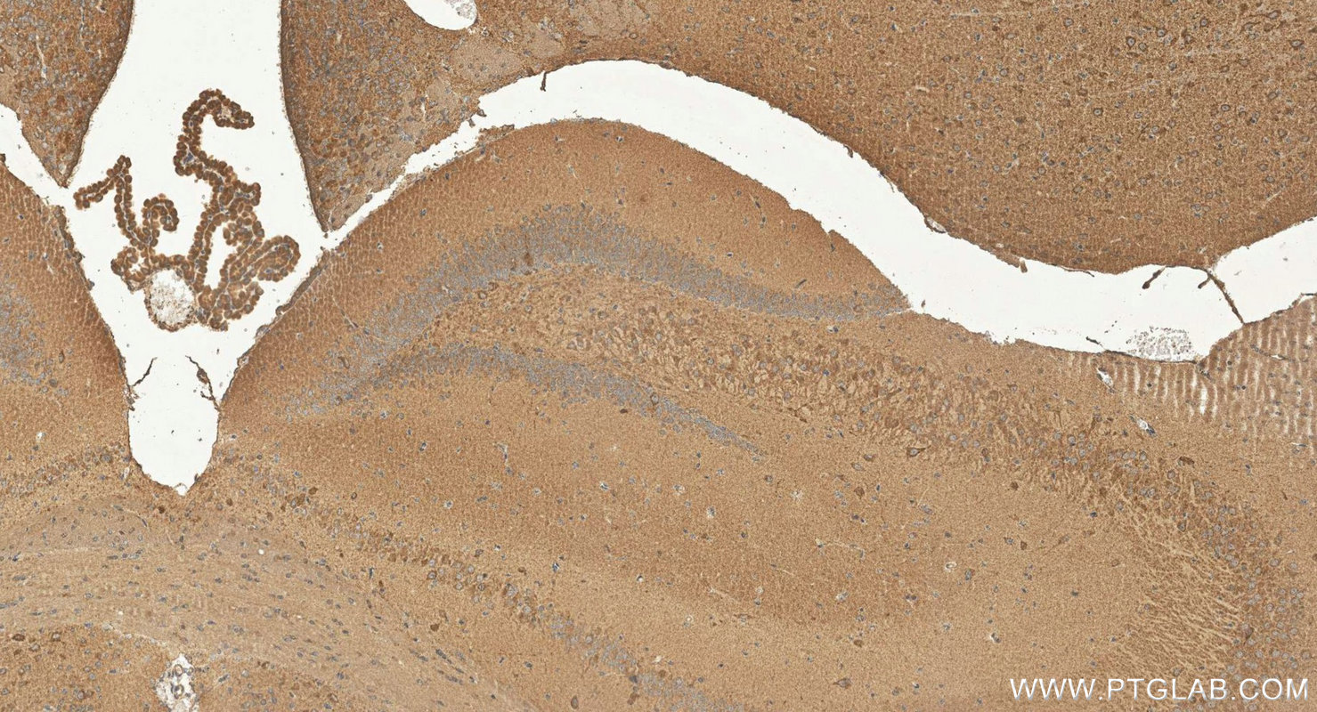 IHC staining of mouse brain using 29924-1-AP (same clone as 29924-1-PBS) IHC staining of mouse brain using 29924-1-AP (same clone as 29924-1-PBS)