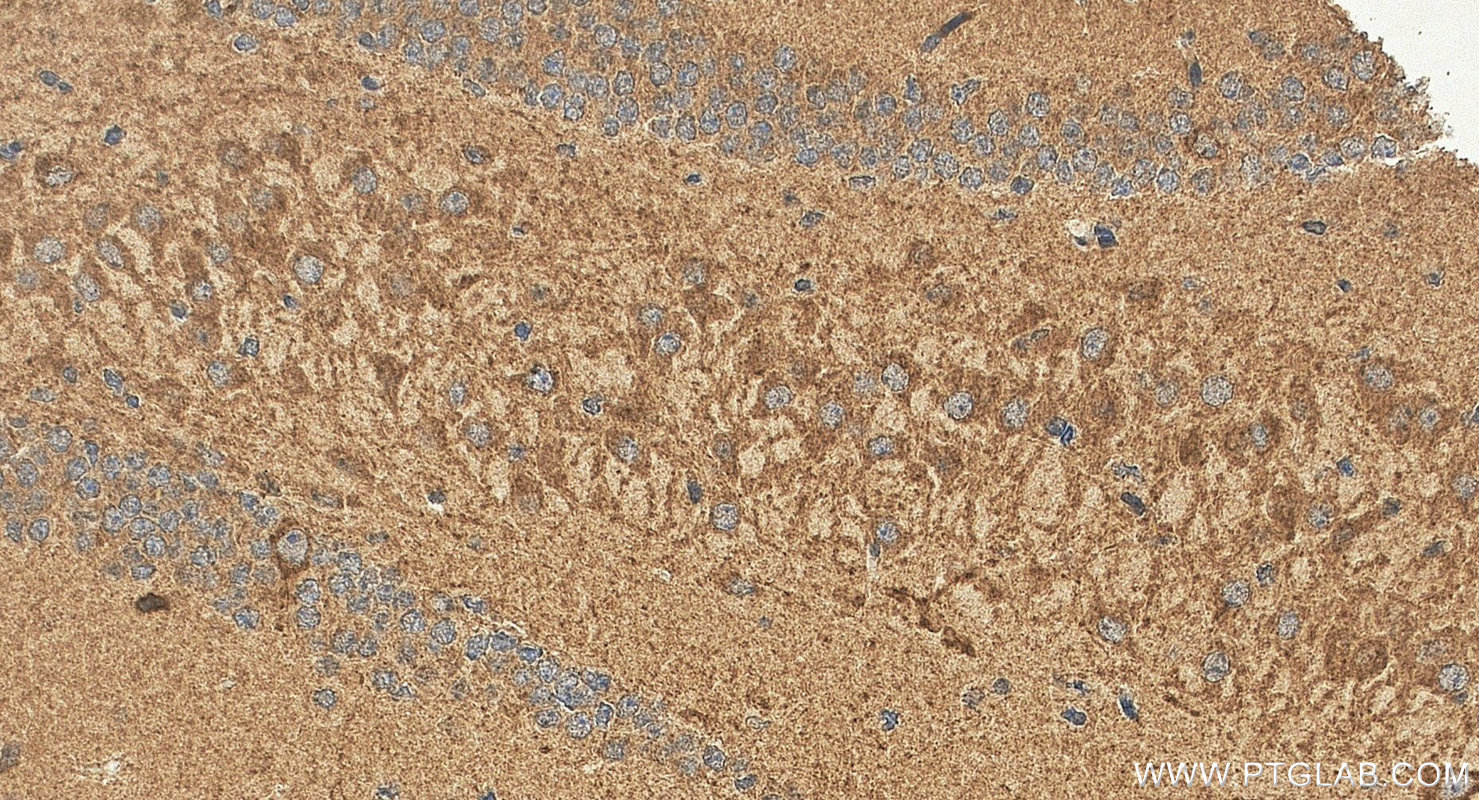 IHC staining of mouse brain using 29924-1-AP (same clone as 29924-1-PBS) IHC staining of mouse brain using 29924-1-AP (same clone as 29924-1-PBS)