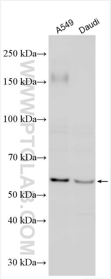 WB analysis using 29924-1-AP