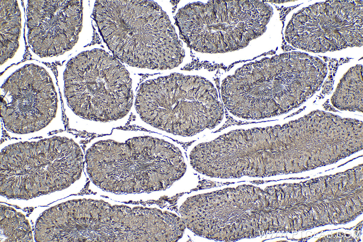 IHC staining of rat testis using 13456-1-AP