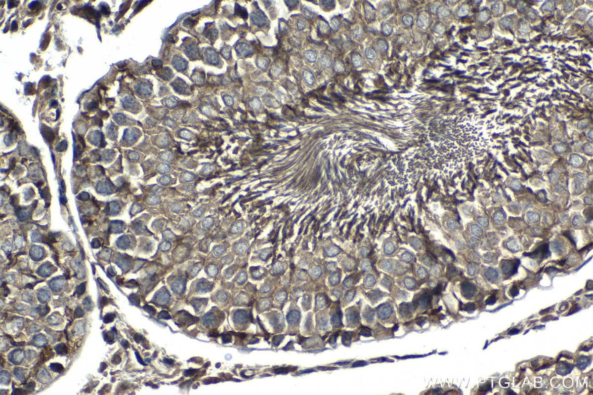 IHC staining of rat testis using 13456-1-AP