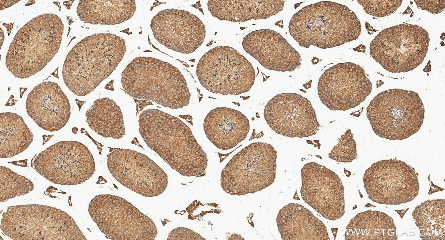 IHC staining of mouse testis using 29892-1-AP IHC staining of mouse testis using 29892-1-AP